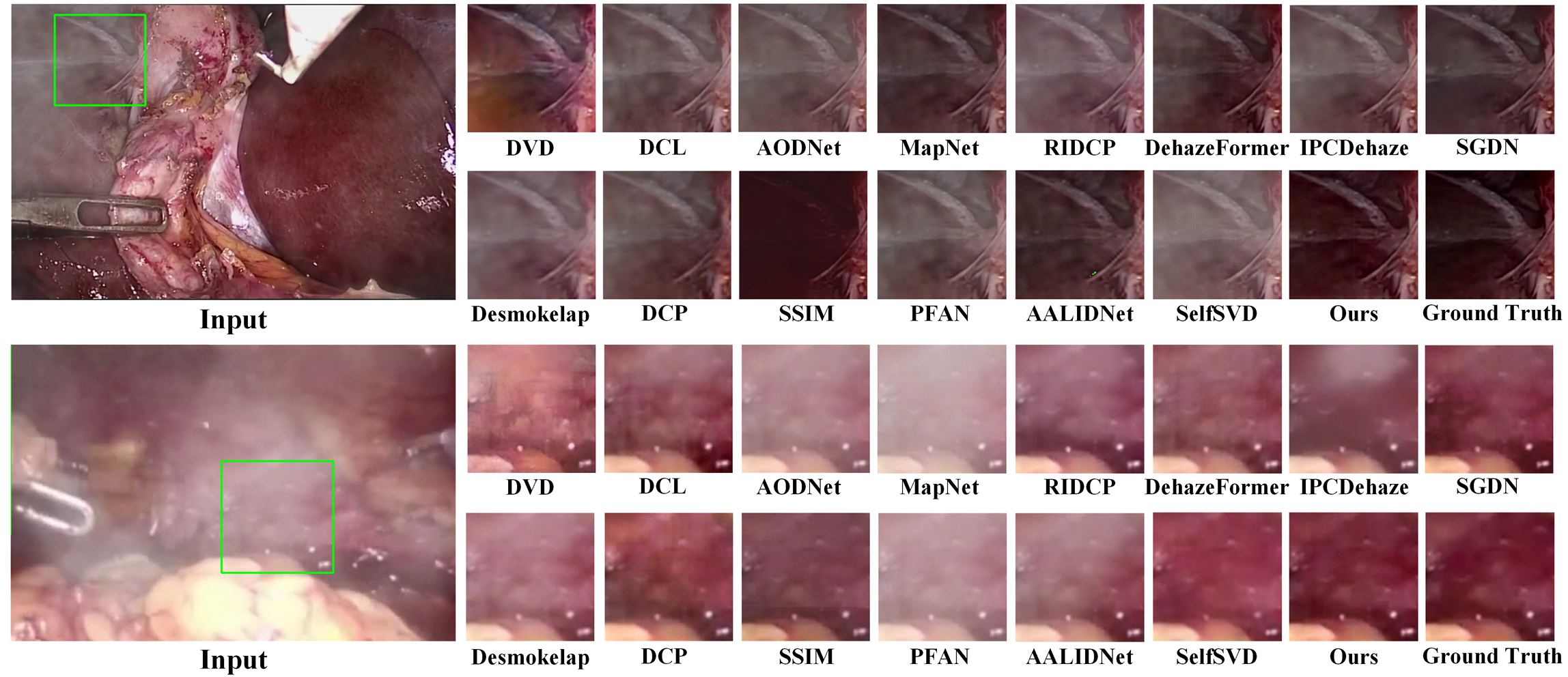 Visual Comparison on STSVD Dataset