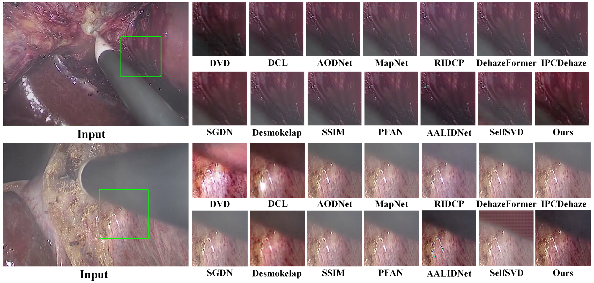Visual Comparison on STSVDR Dataset